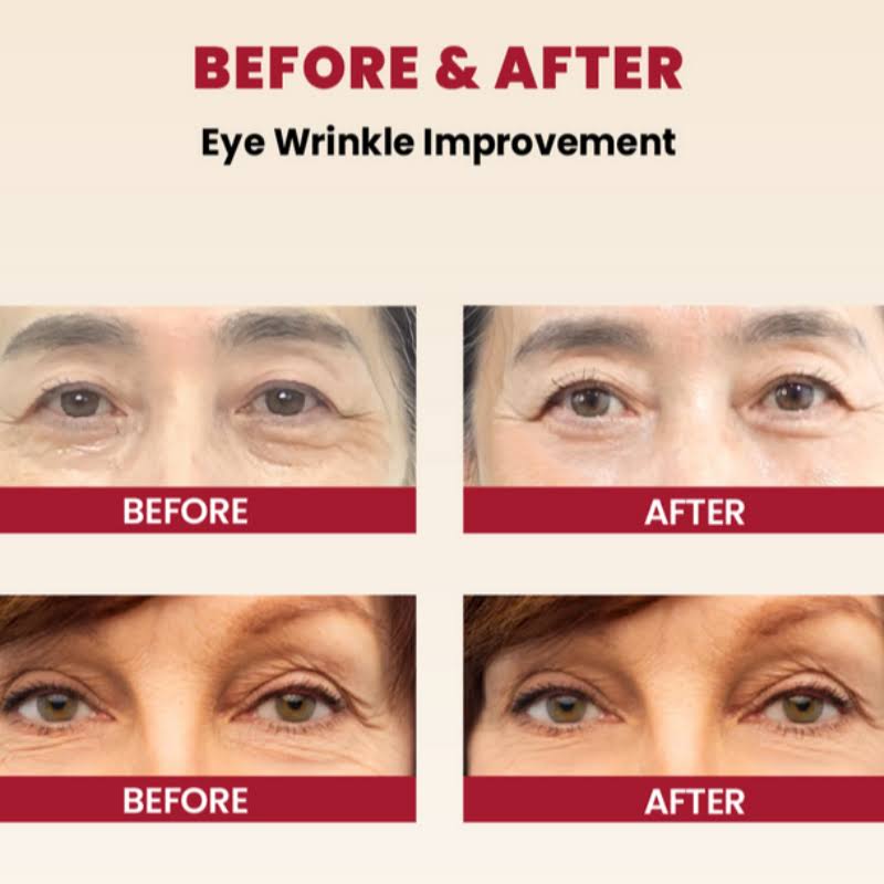KSECRET - SEOUL 1988 Eye Cream : Retinal Liposome 4% + Fermented Bean| Contorno para ojos