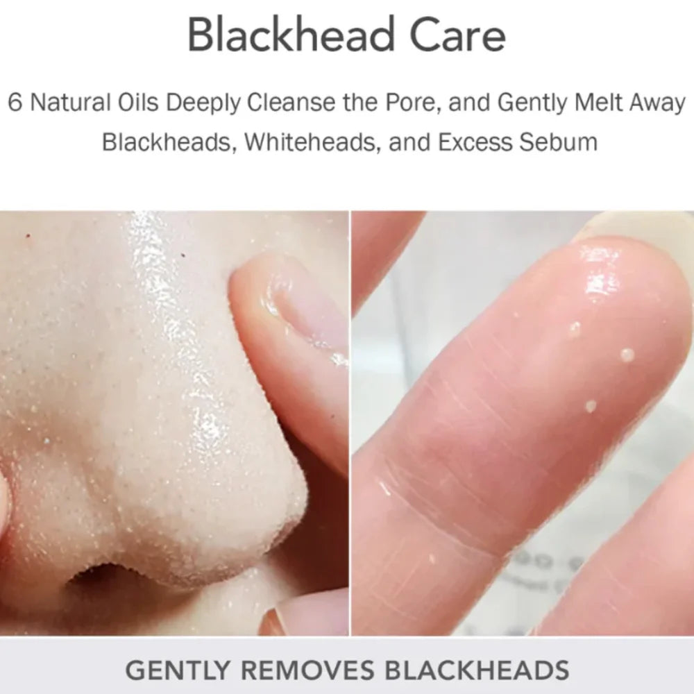 CELIMAX - Derma Nature Fresh Blackhead Jojoba Cleansing Oil - 150ml | limpiador facial