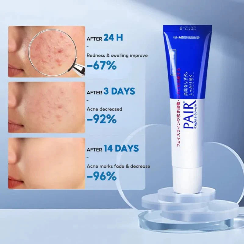 PAIR Acné Cream W 14 g