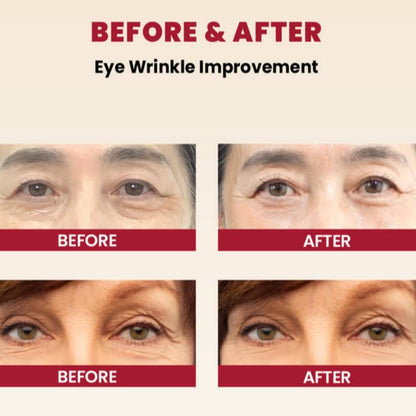KSECRET - SEOUL 1988 Eye Cream : Retinal Liposome 4% + Fermented Bean| Contorno para ojos